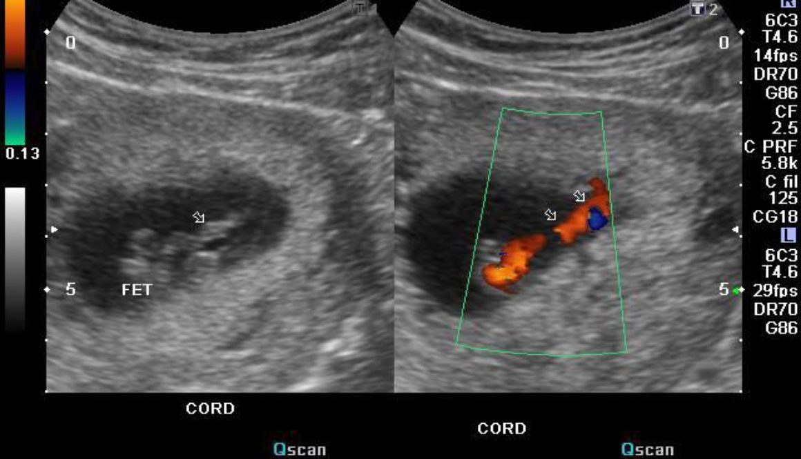 Sonography – What is it?