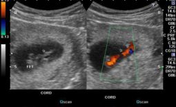 Sonography – What is it?