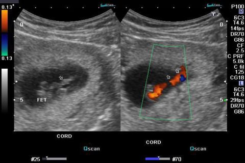 Sonography – What is it?