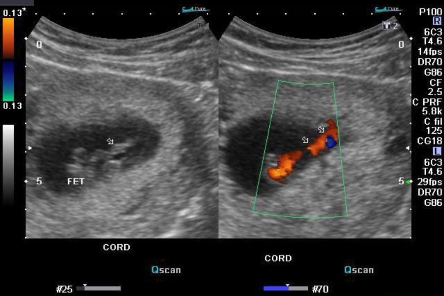 Sonography – What is it?